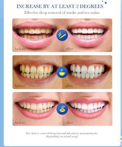 White plus toothpaste - smoke stain, coffee stain, tooth decay and bad breath remover