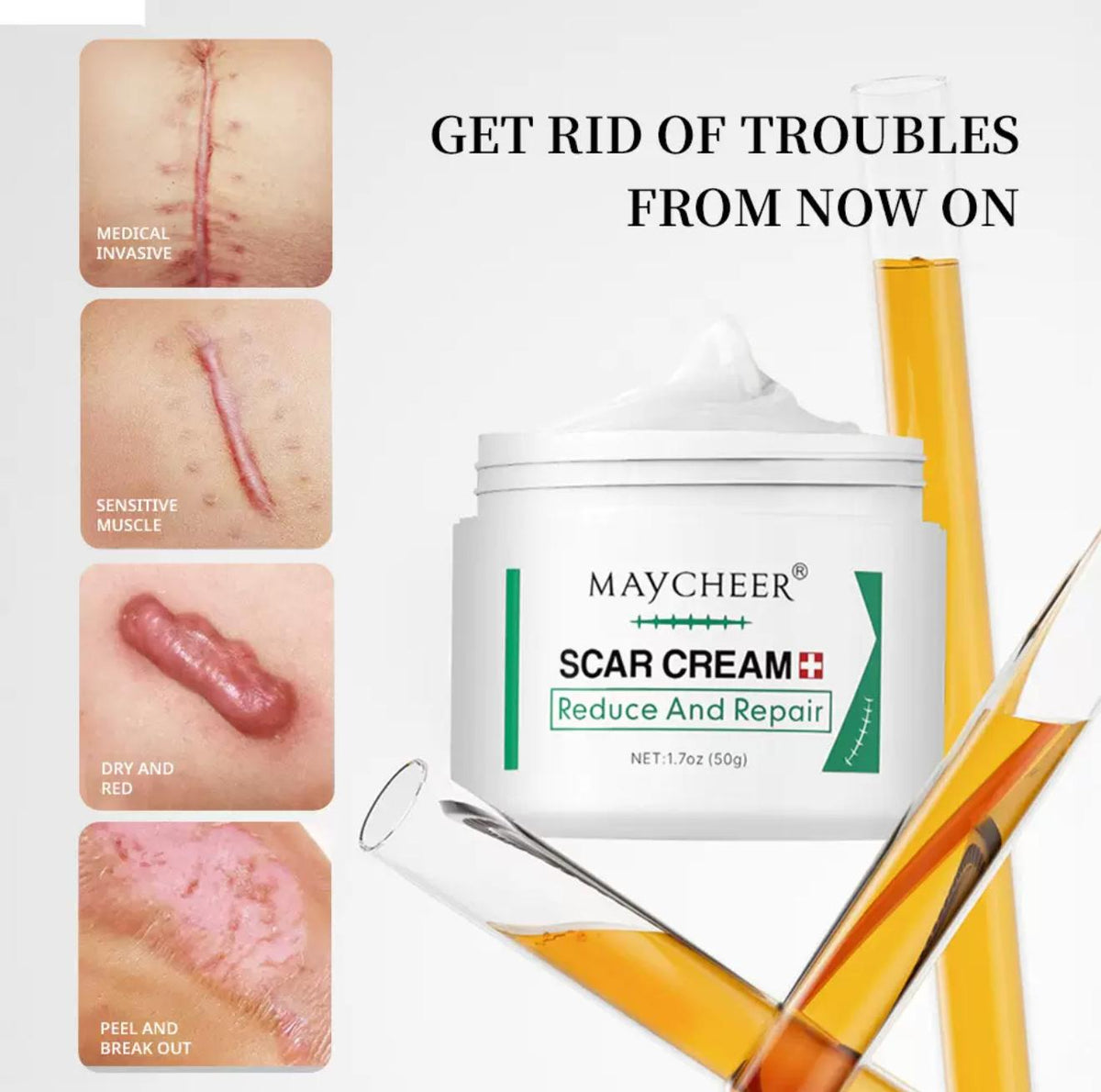 Maycheer scar And Stretch mark removal
