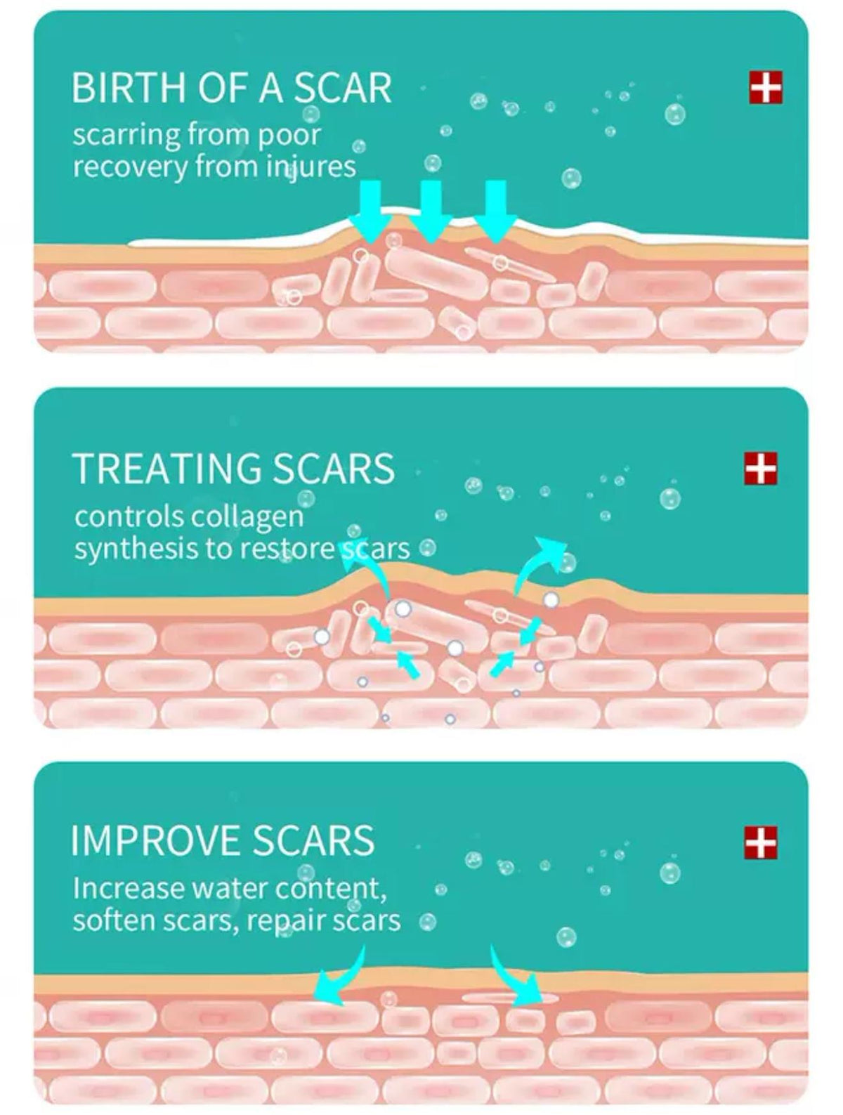 Maycheer scar And Stretch mark removal