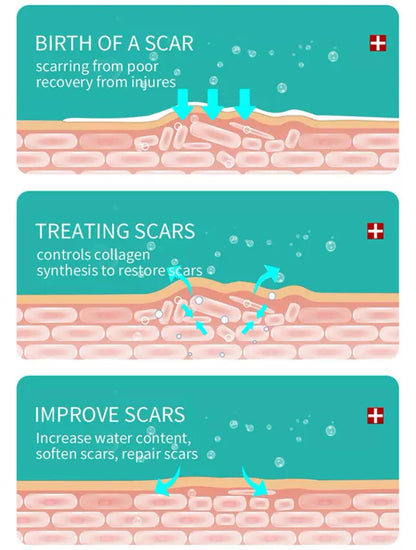 Maycheer scar And Stretch mark removal
