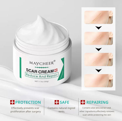 Maycheer scar And Stretch mark removal
