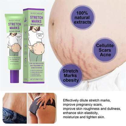 Maycheer Stretch Marks Repair Cream