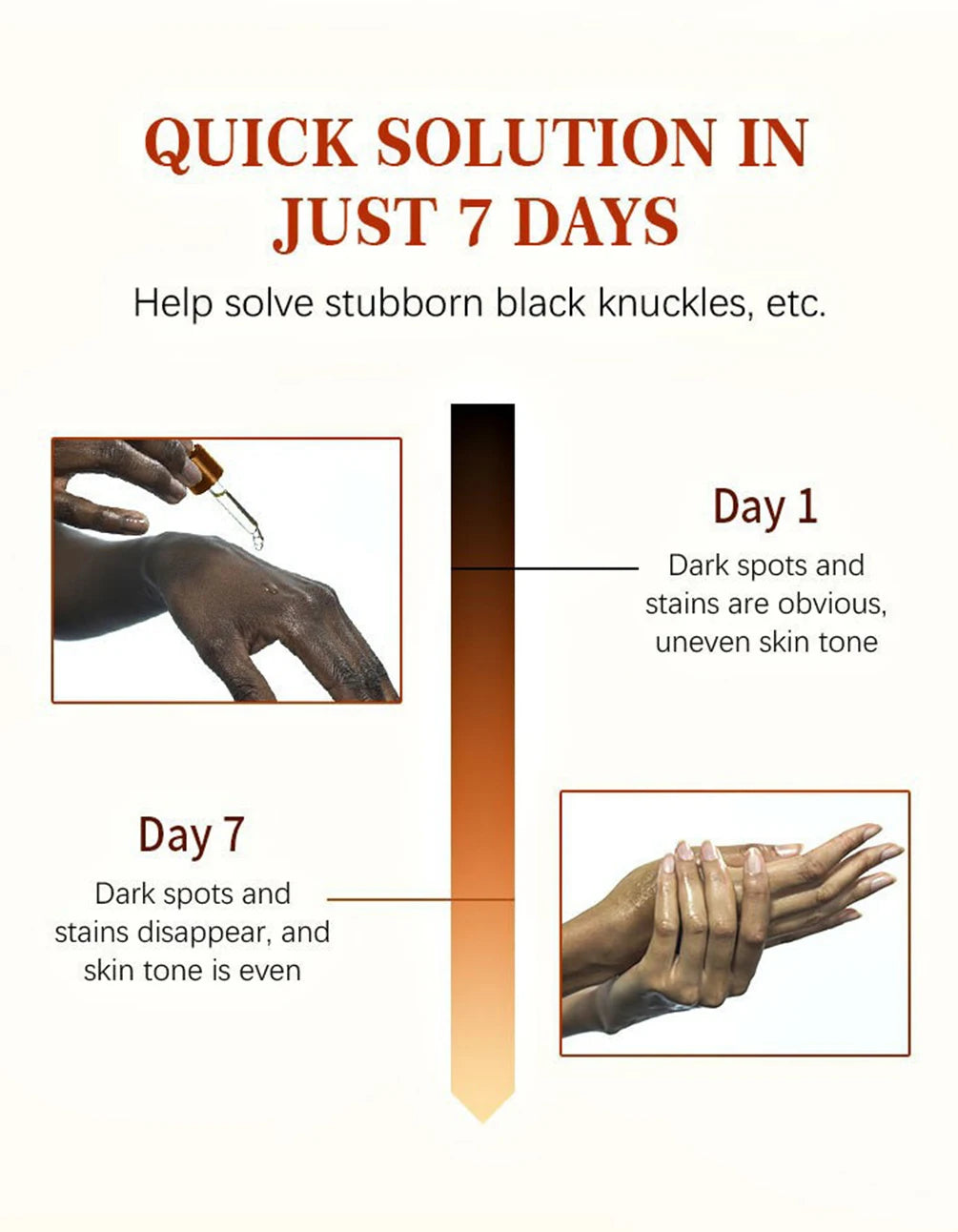 Luxury 50ml Dark Knuckles removal for Hand, Finger and Joints