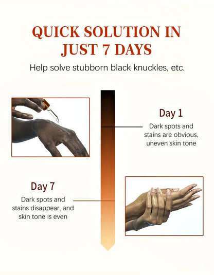 Luxury 50ml Dark Knuckles removal for Hand, Finger and Joints