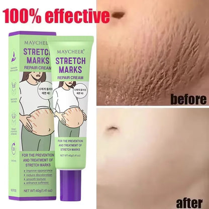 Maycheer Stretch Marks Repair Cream