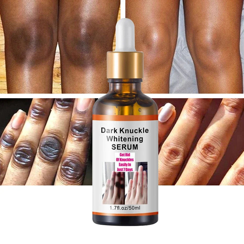 Luxury 50ml Dark Knuckles removal for Hand, Finger and Joints
