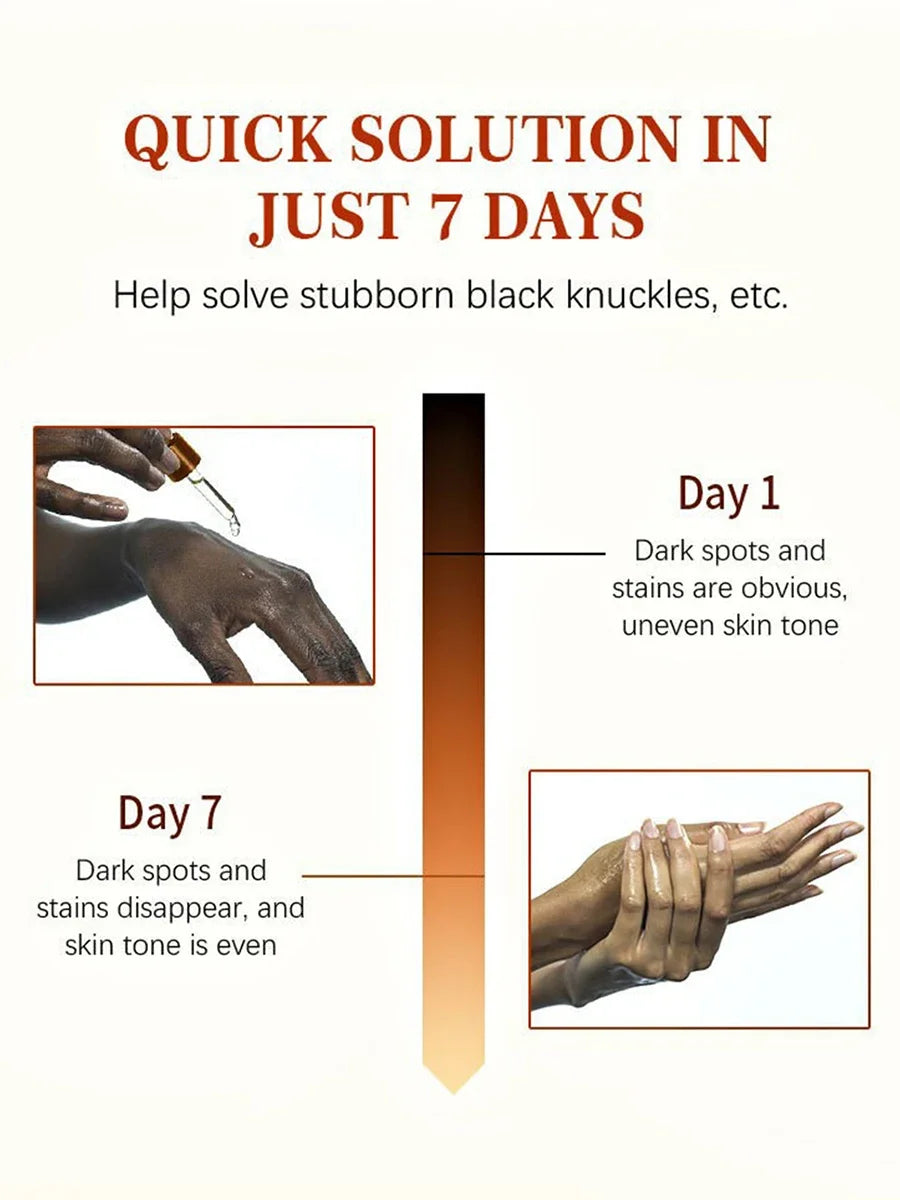 Luxury 50ml Dark Knuckles removal for Hand, Finger and Joints