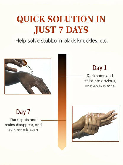 Luxury 50ml Dark Knuckles removal for Hand, Finger and Joints