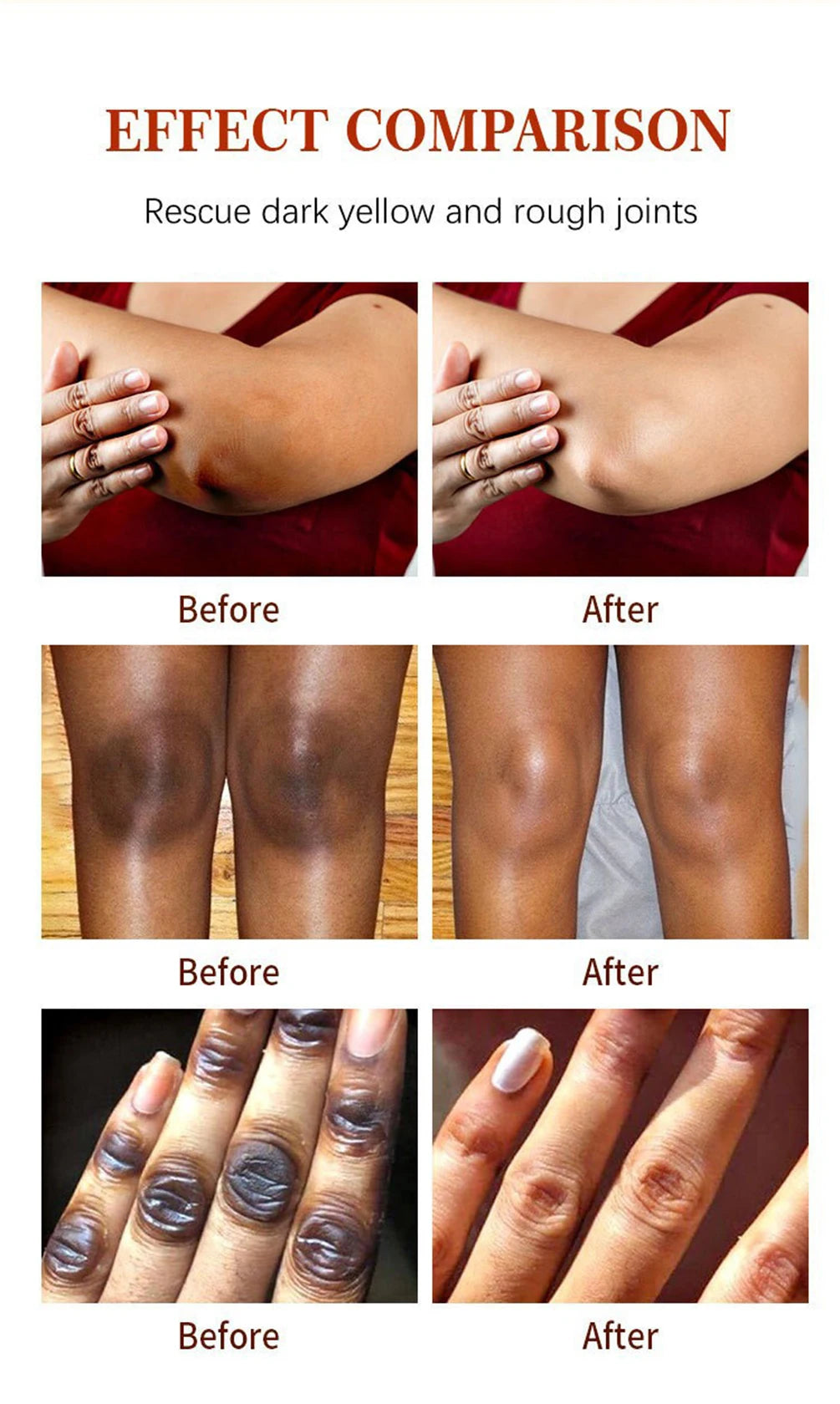 Luxury 50ml Dark Knuckles removal for Hand, Finger and Joints