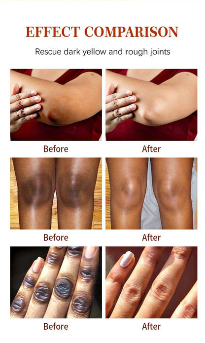 Luxury 50ml Dark Knuckles removal for Hand, Finger and Joints