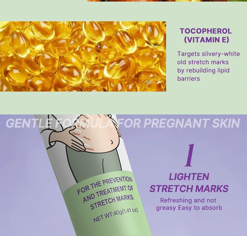 Maycheer Stretch Marks Repair Cream