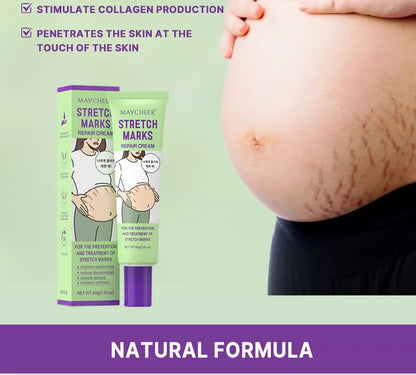 Maycheer Stretch Marks Repair Cream