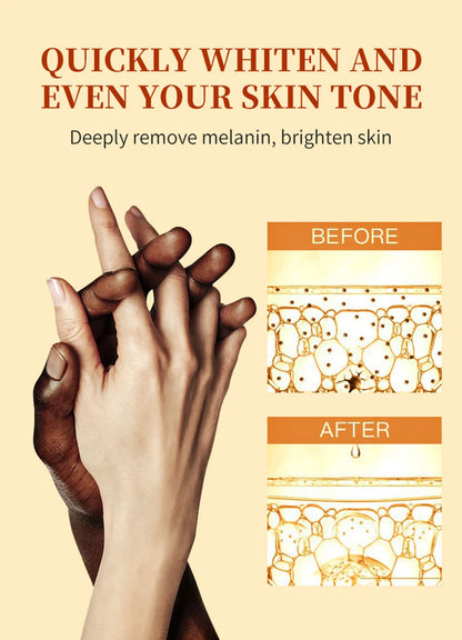 Luxury 50ml Dark Knuckles removal for Hand, Finger and Joints