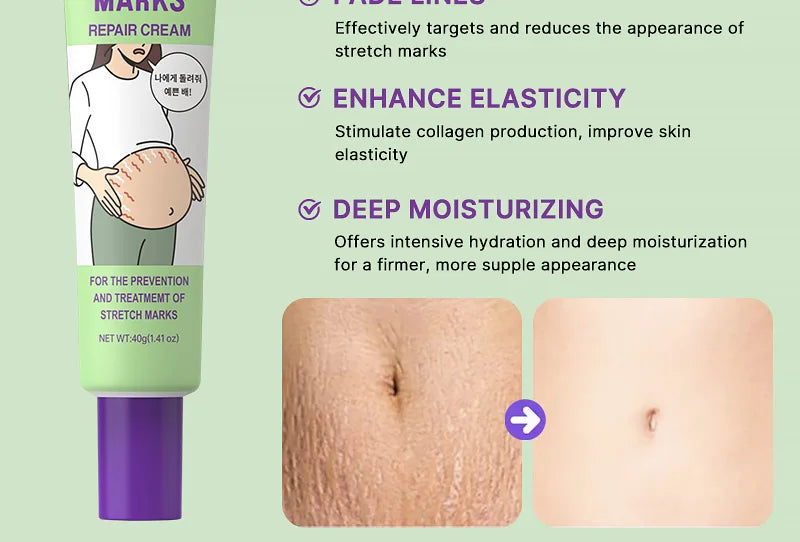 Maycheer Stretch Marks Repair Cream