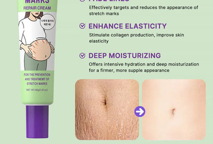 Maycheer Stretch Marks Repair Cream