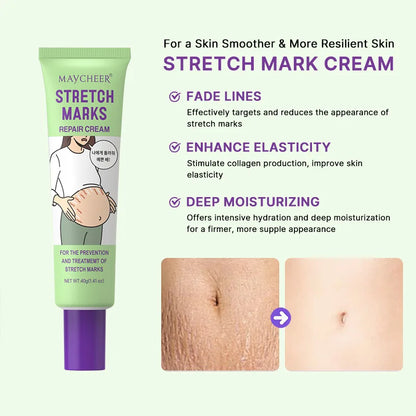 Maycheer Stretch Marks Repair Cream