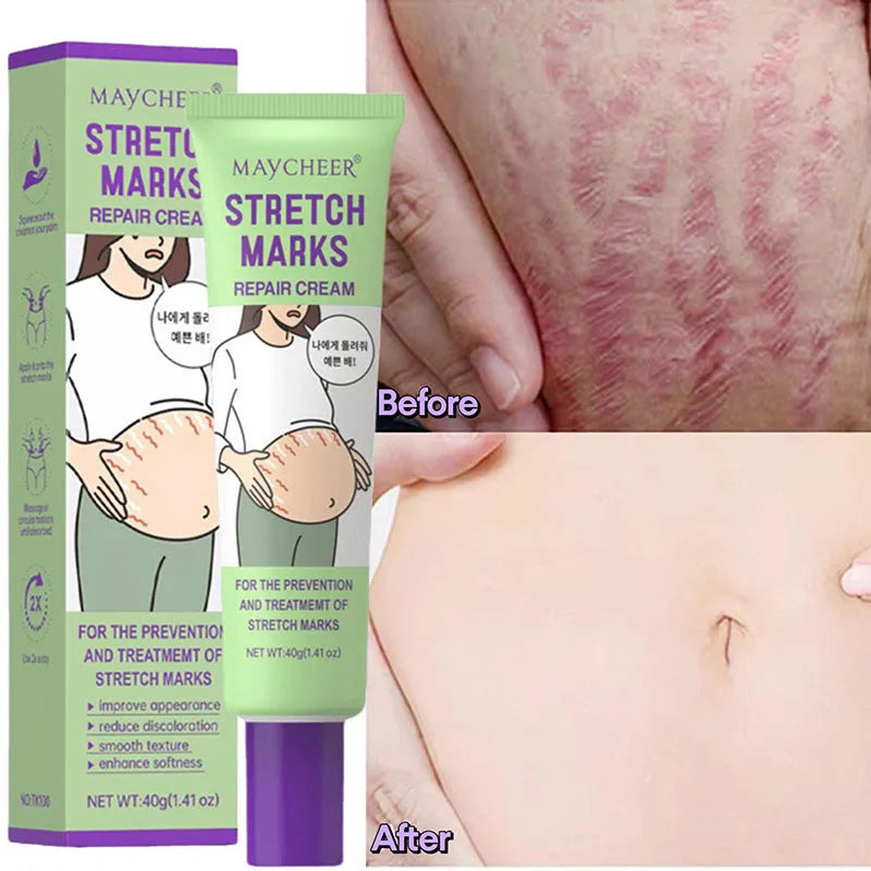 Maycheer Stretch Marks Repair Cream