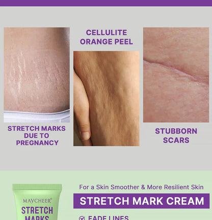 Maycheer Stretch Marks Repair Cream